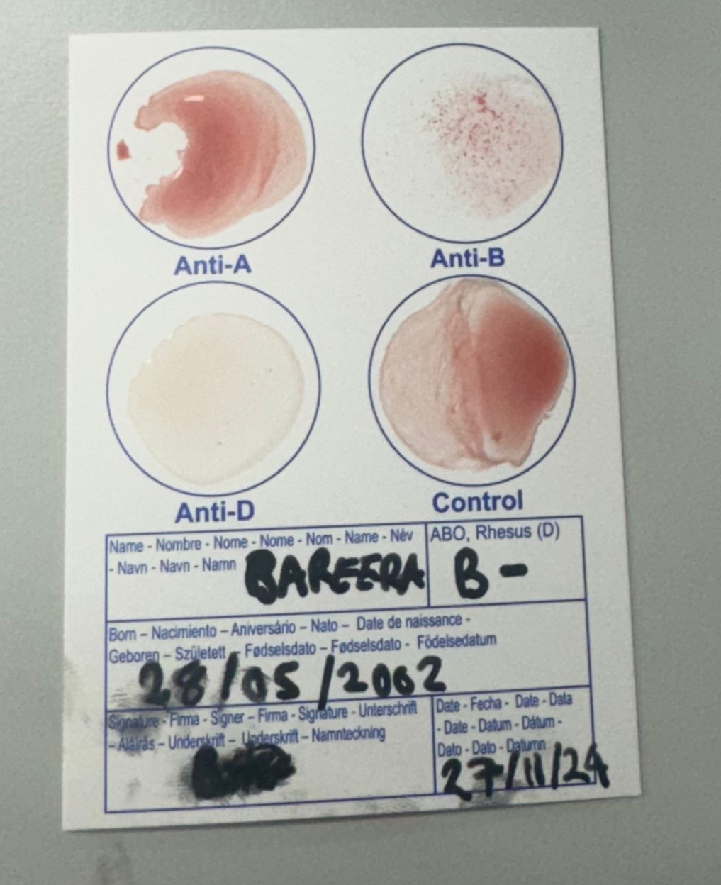 Determine blood group through Eldon card analysis