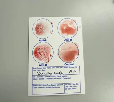 Figure 1: Finding out the Proper Blood Group
