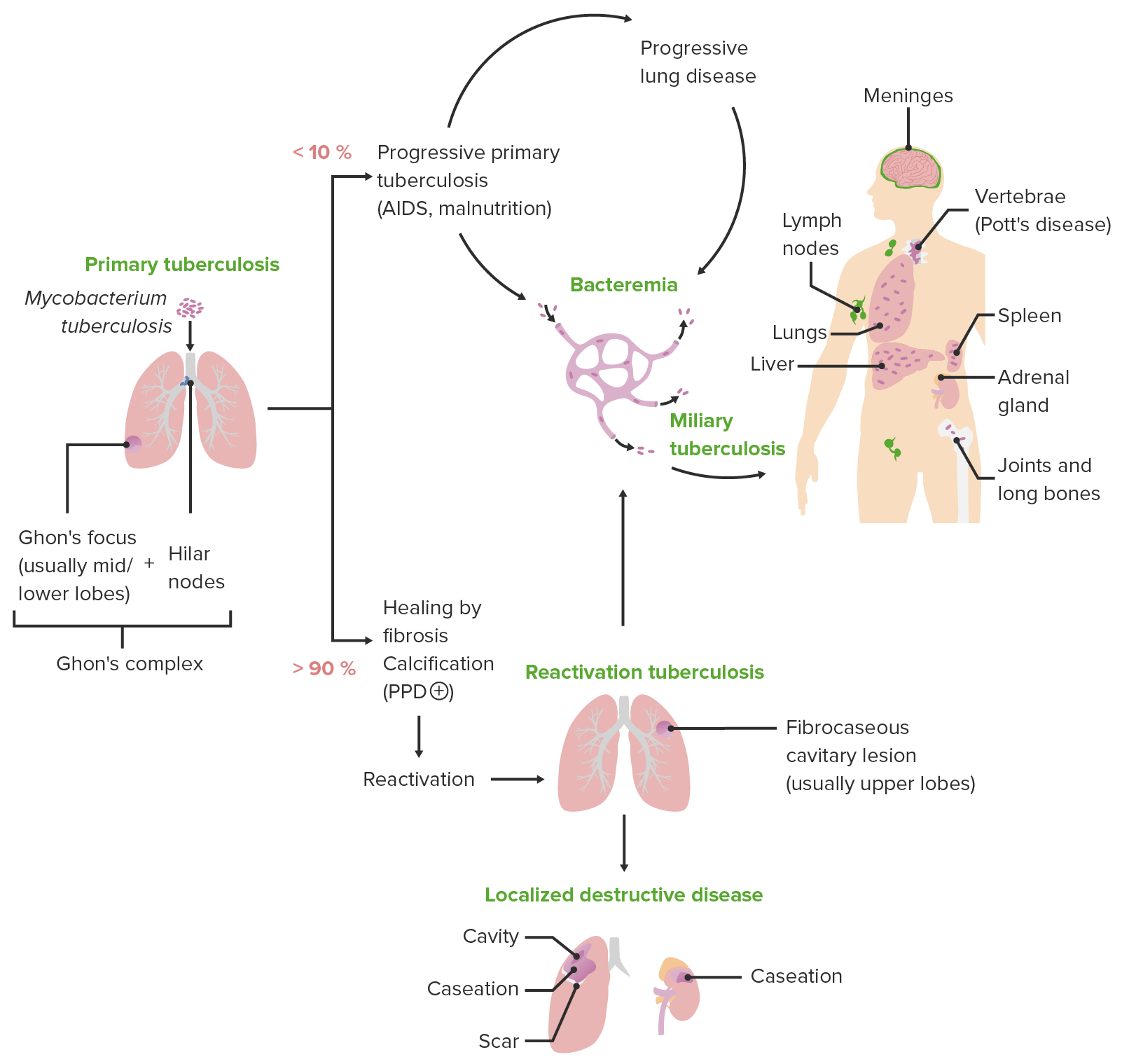Life cycle of Tuberculosis