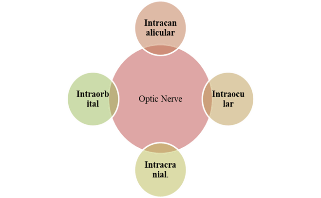 Types of Optic Nerve